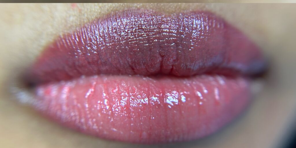 Dark Lip Neutralization – Even-Toned Lip Enhancement after treatment