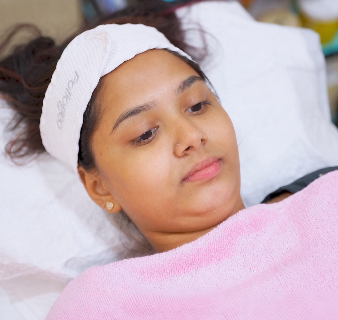 HydraFacial – Deep Cleansing & Hydration before treatment