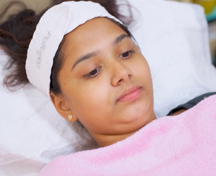 HydraFacial – Deep Cleansing & Hydration before treatment